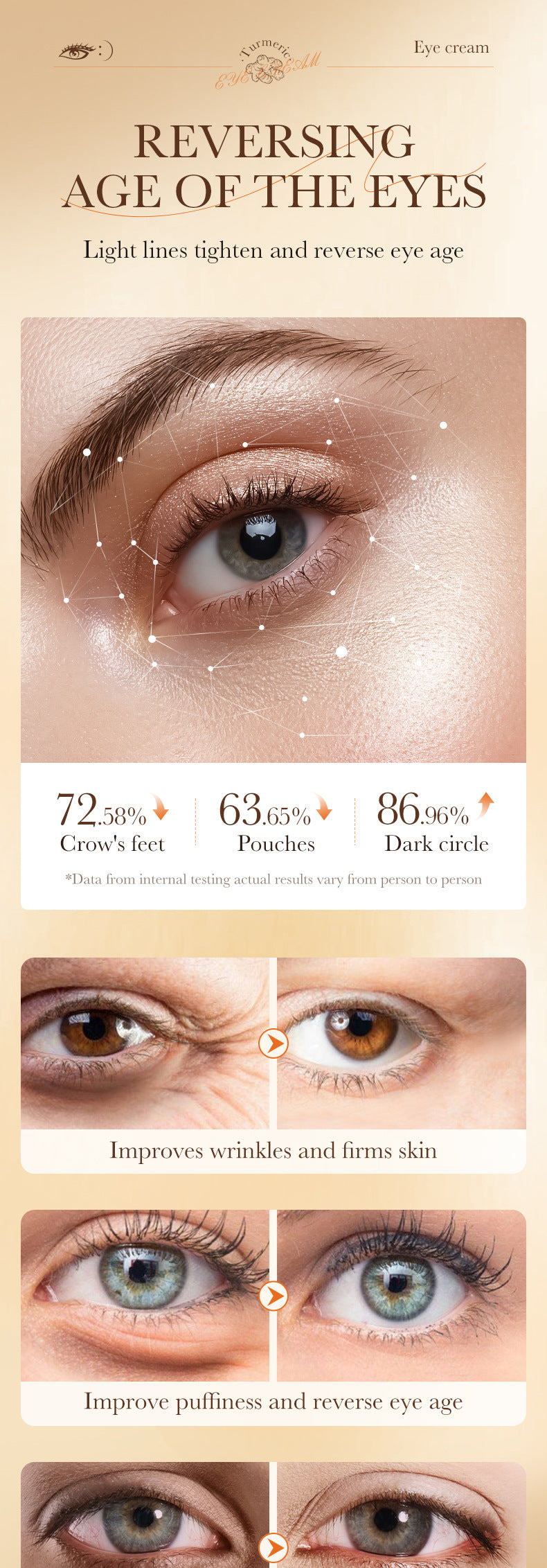 Full English Turmeric Eye Cream SADOER Moisturize and Improve Dark Circles, Eye Lines, Eye Bags,  Wholesale